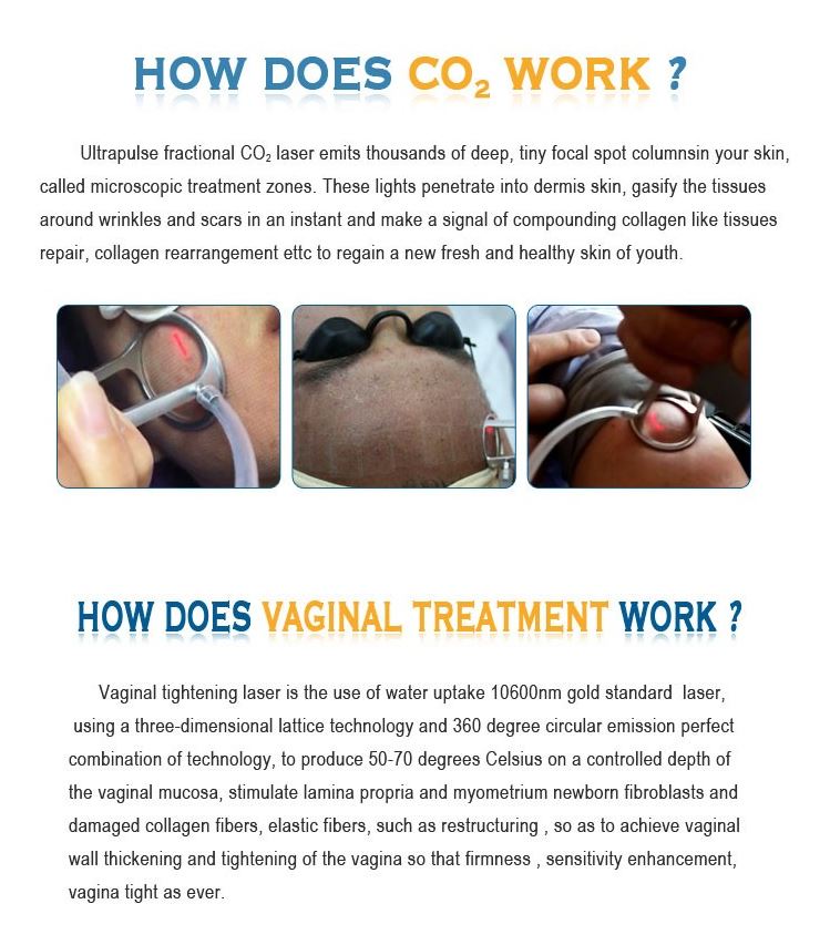 Co2 Laser Vaginal Tightening Beauty Machine