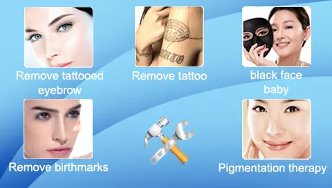 Best-selling Tattoo Removal Beauty Machine
