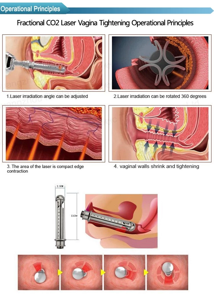 vertical fractional co2 laser equipment/co2 fractional laser for Scar Removal/fractional co2 laser